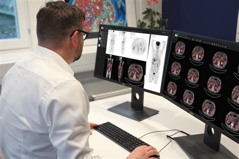 hermes molecular imaging software